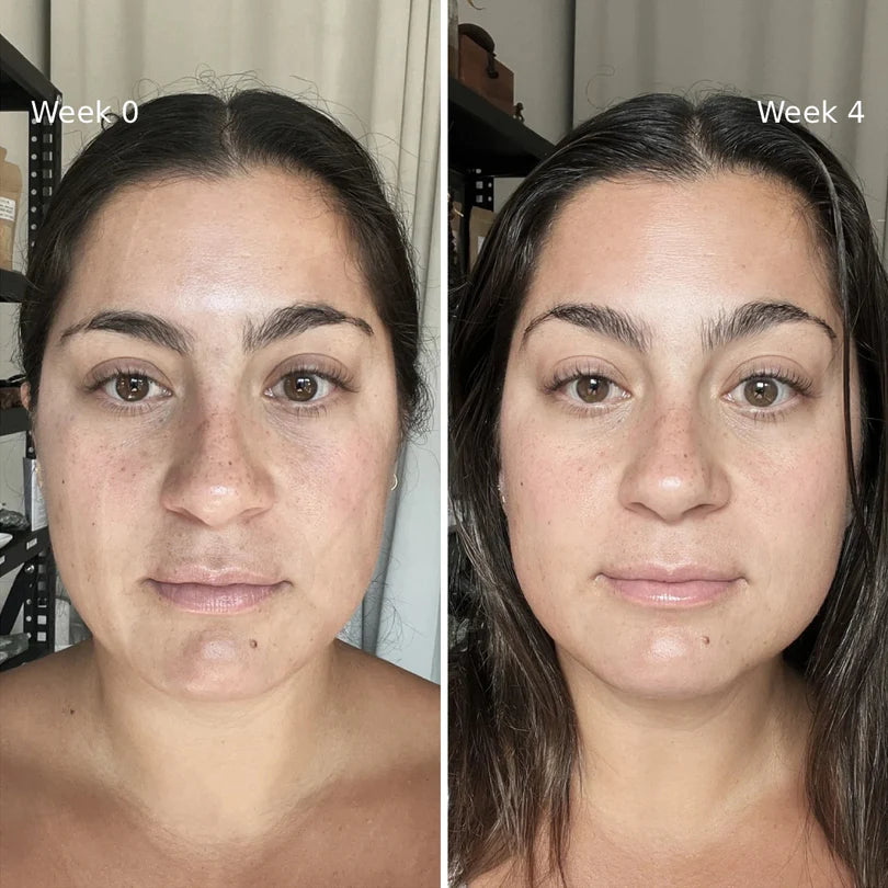 Facial Repair Device