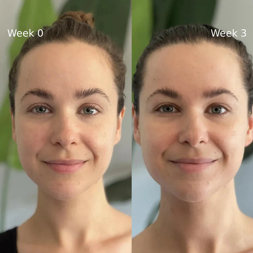 Facial Repair Device