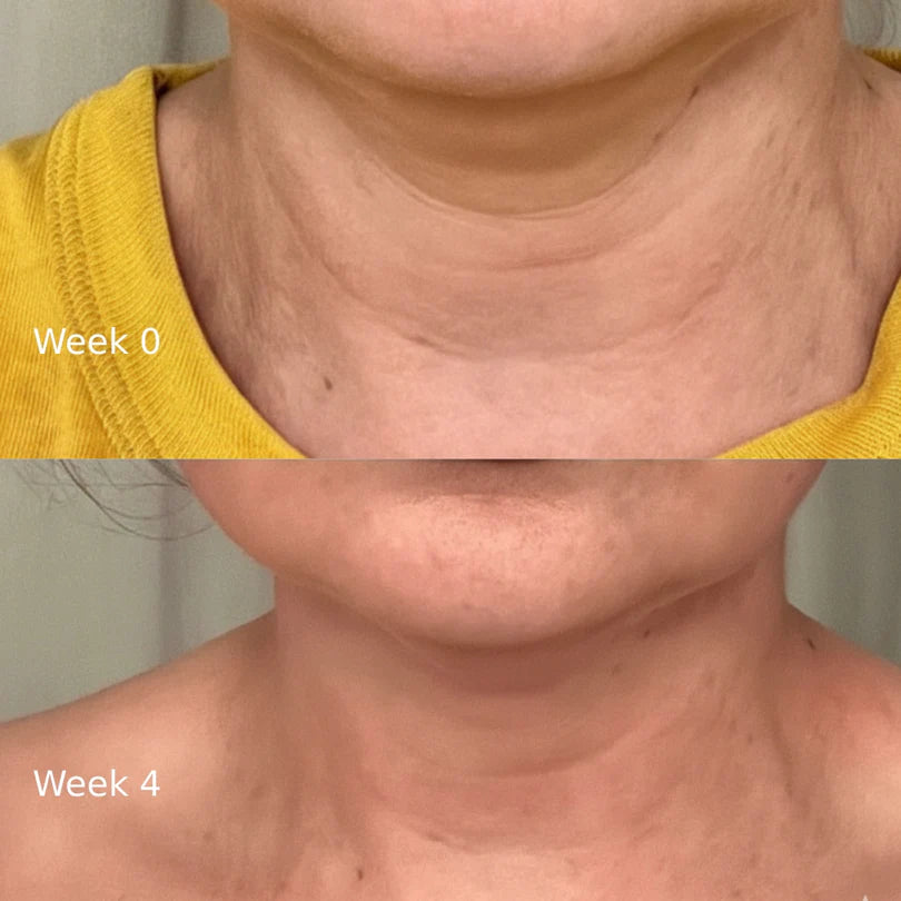 Facial Repair Device