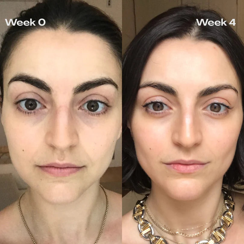 Facial Repair Device